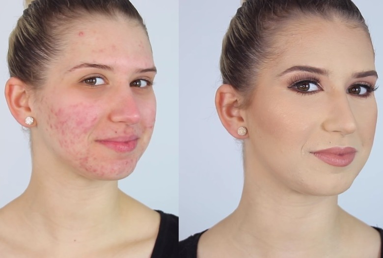 Hoe Doe Je Make Up Op Bij Een Huid Met Acne